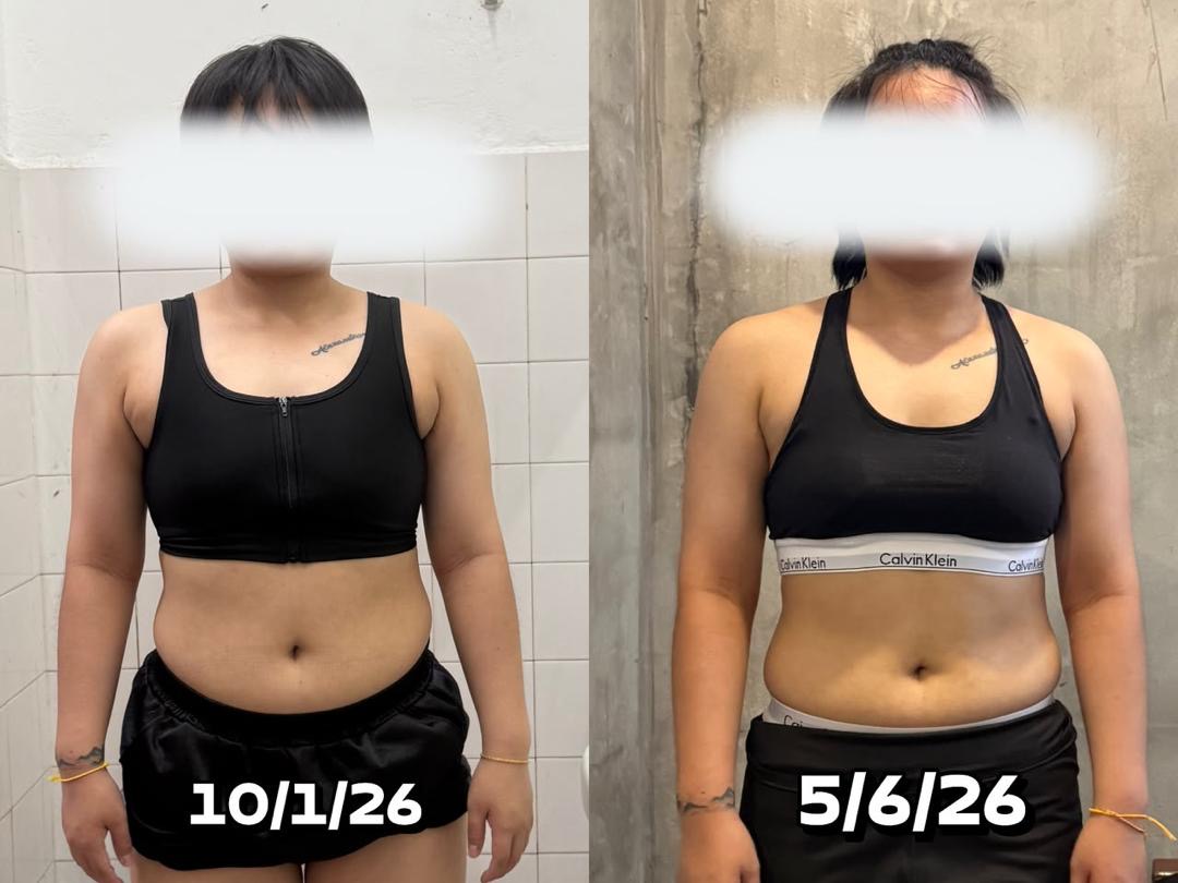 3AF client progress comparison photographed in January and June